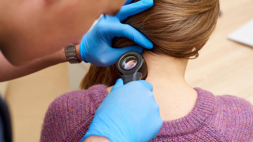 Ein Arzt untersucht bei einem Hautkrebs-Screening die Haut einer Frau mit einer Lupe