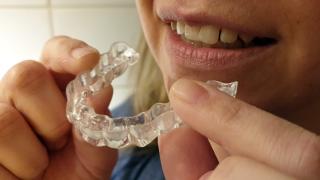 Hände halten transparente Zahnschiene vor geöffnetem Mund
